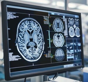 Aktuelle Möglichkeiten und Perspektiven der funktionellen chirurgischen Neuroonkologie