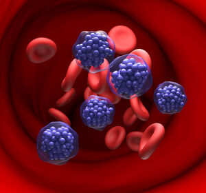 Epcoritamab als Add-on für Pola-R-CHP beim DLBCL?