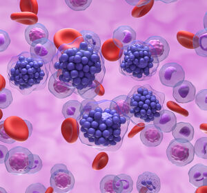 DLBCL-Drittlinienbehandlung mit fixer Therapiedauer: Anti-CD20/Anti-CD3-Antikörper Glofitamab i.v. ermöglicht rasche, anhaltende und tiefe Remissionen