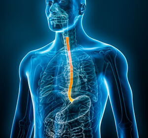 Verbessertes Gesamtüberleben mit Tislelizumab bei NSCLC und ESCC