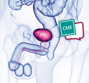 Systemische Therapie des metastasierten Urothelkarzinoms: Aktuelle Standards und Ausblick