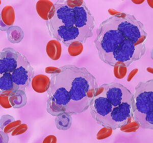 DGHO 2024: Epcoritamab als neu verfügbare Therapieoption beim RRFL verbessert Lebensqualität