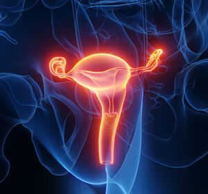 Neues zur Rezidivtherapie des Endometriumkarzinoms