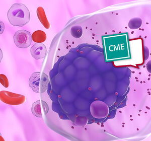 Neue Entwicklungen in der Diagnostik und Therapie des Smoldering Multiplen Myeloms