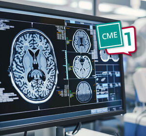 Aktuelle Möglichkeiten und Perspektiven der funktionellen chirurgischen Neuroonkologie