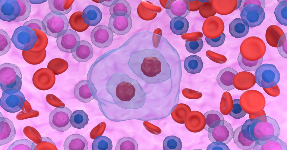 EHA: BrECADD neuer Standard beim fortgeschrittenen Hodgkin-Lymphom