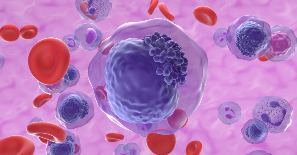 BCR::ABL1-positive ALL: Identifikation von prognostisch relevanten molekularen Subtypen