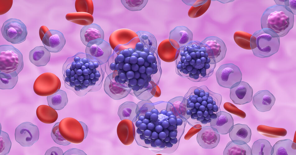 DLBCL-Drittlinienbehandlung mit fixer Therapiedauer: Anti-CD20/Anti-CD3-Antikörper Glofitamab i.v. ermöglicht rasche, anhaltende und tiefe Remissionen