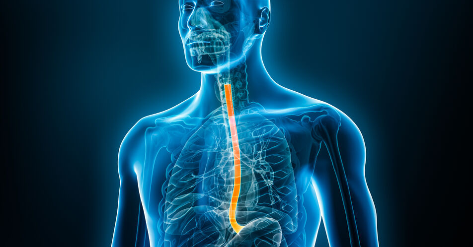 Verbessertes Gesamtüberleben mit Tislelizumab bei NSCLC und ESCC