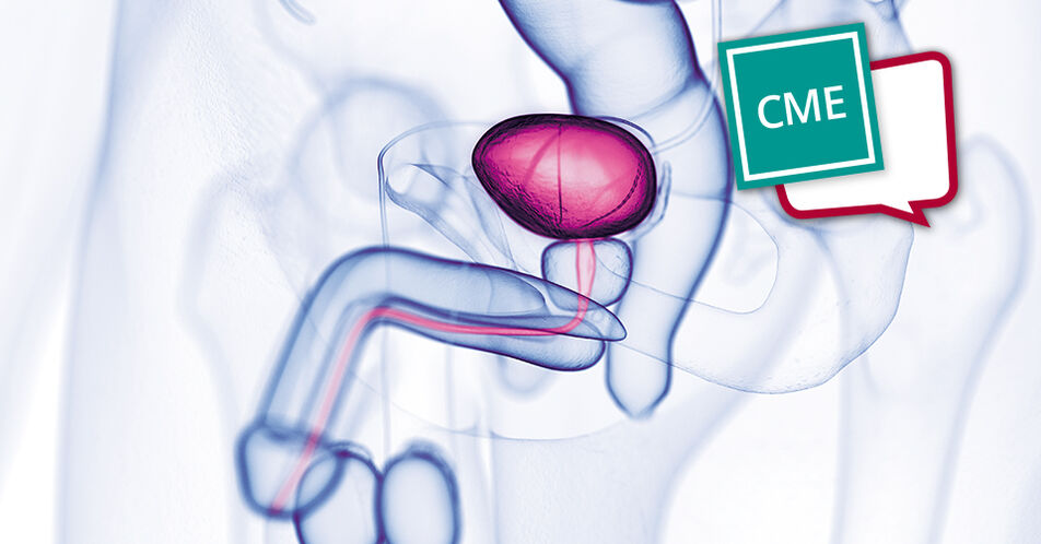 Systemische Therapie des metastasierten Urothelkarzinoms: Aktuelle Standards und Ausblick