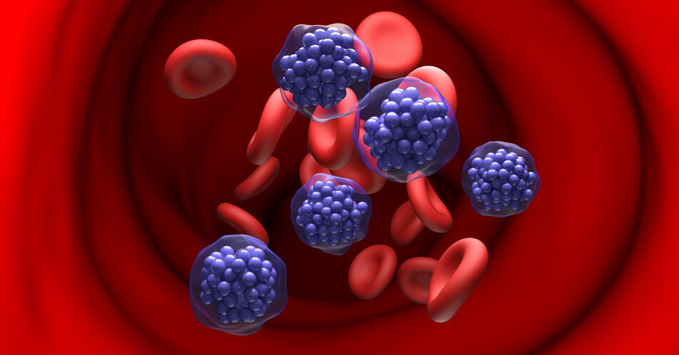 DGHO 2024: Bewährte Standards, Fortschritte und neue Perspektiven für DLBCL und PNH