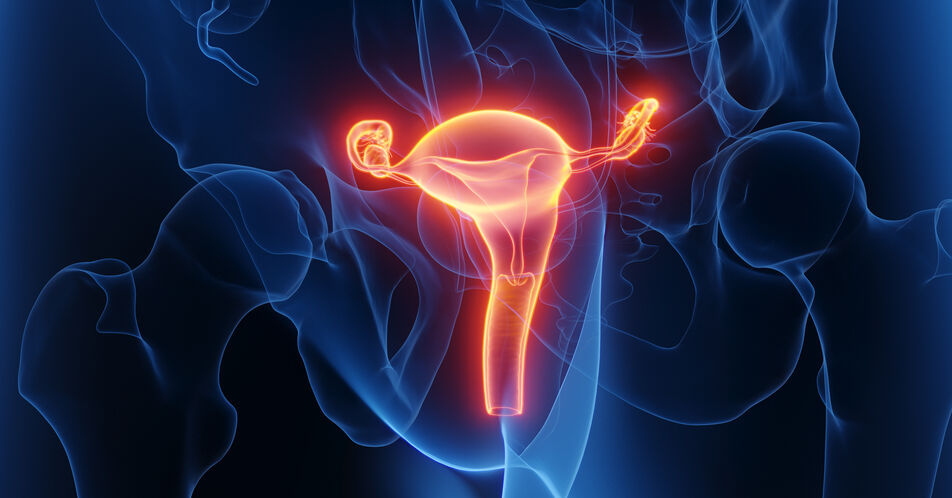 Neues zur Rezidivtherapie des Endometriumkarzinoms