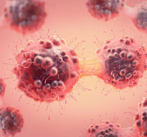 Neue Wege in der Krebsnachsorge: Die Bedeutung der Tumor-DNA-Analyse