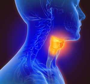 Fortgeschrittene Kopf-Hals-Tumoren: Welche Faktoren beeinflussen die Wahl der Erstlinie?