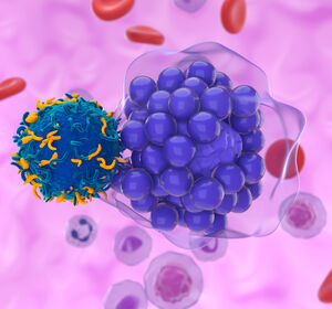DLBCL: Das kurative Potenzial von CAR-T-Zellen in der Zweitlinie besser nutzen