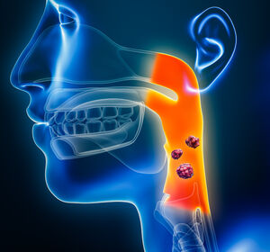 ESMO: r/m Kopf- Hals-Tumoren: Nach Therapieversagen von Checkpoint-Inhibitoren ist Paclitaxel + Cetuximab eine potenzielle Zweitlinientherapie