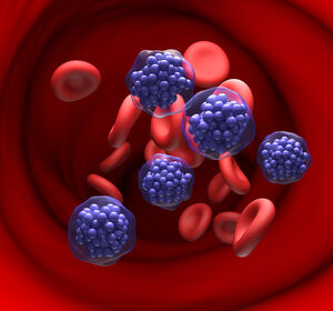 DLBCL und PNH: Bewährte Standards, Fortschritte und neue Perspektiven