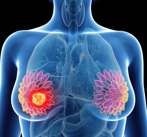 Zulassungsempfehlung für Ribociclib zur Behandlung des frühen HR+/HER2- Mammakarzinoms