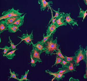 Studie identifiziert Subtypen von Fibroblasten bei Hautkrebs