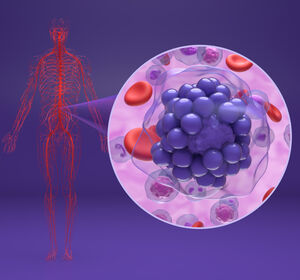 ASH: Polatuzumab Vedotin bei DLBCL auch nach 5 Jahren deutlich im Vorteil