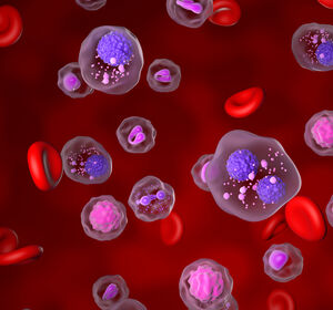 ASH: Daratumumab verzögert Progression des smoldering Multiplem Myelom in AQUILA-Studie