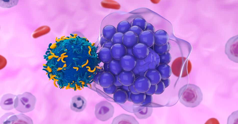 DLBCL: Das kurative Potenzial von CAR-T-Zellen in der Zweitlinie besser nutzen