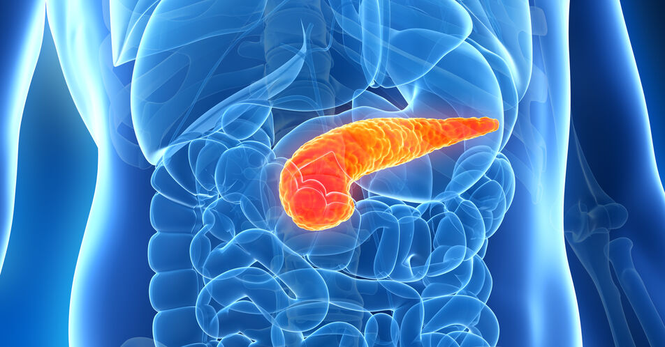 Metastasiertes Pankreaskarzinom: Neuzulassung in der Erstlinie – Überlebensvorteil mit NALIRIFOX