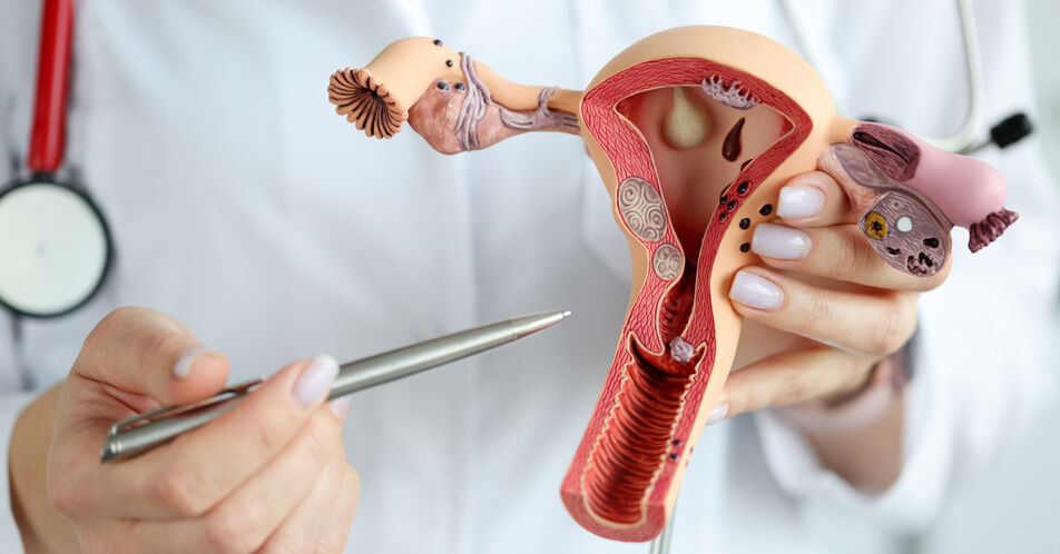 S3-Leitlinie zum Endometriumkarzinom aktualisiert