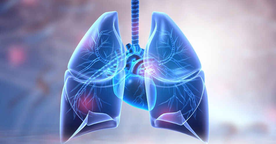 Atezolizumab vielversprechende Option für NSCLC-Patient:innen