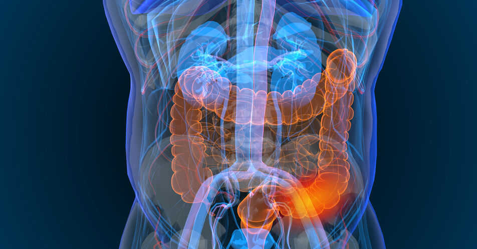 Anti-EGFR-Rechallenge: CITRIC-Studie belegt Potenzial der Cetuximab-Irinotecan-Kombination bei mCRC