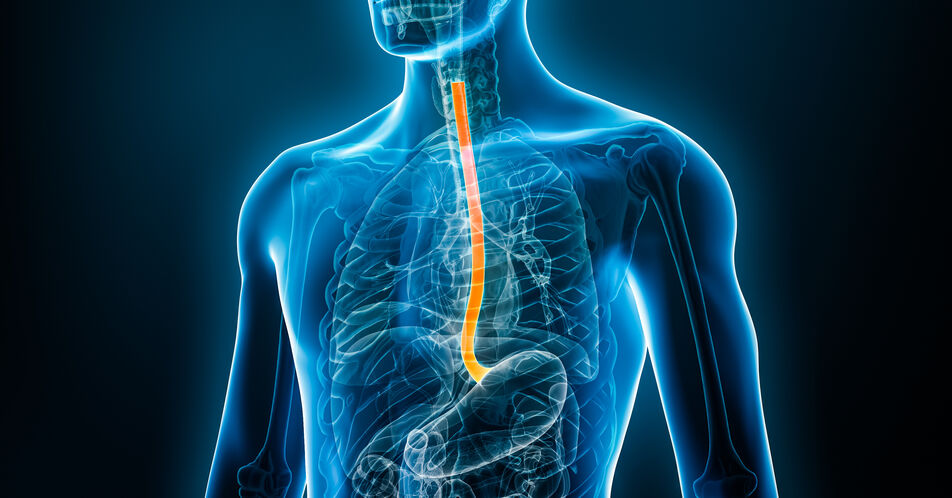 EU-Zulassung für Tislelizumab zur Erstlinienbehandlung des metastasierten Karzinoms der Speiseröhre, des Magens oder des gastroösophagealen Übergangs