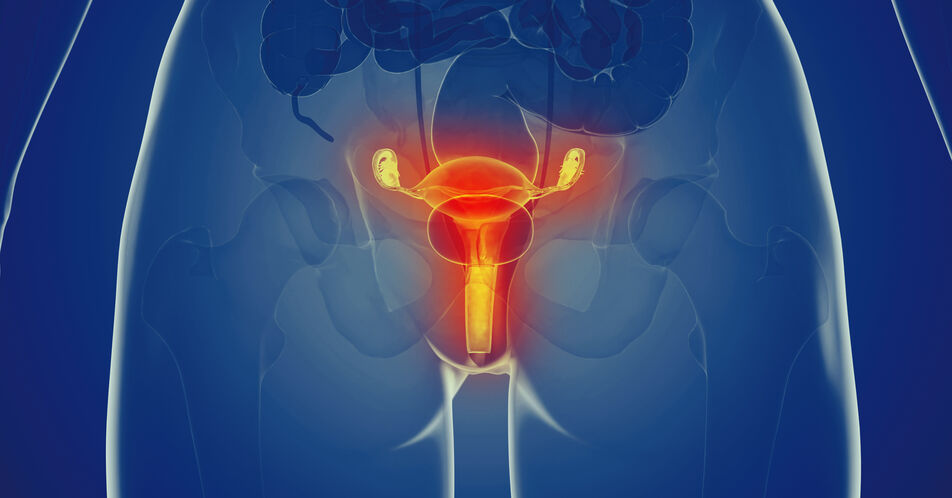 Zervix- und Endometriumkarzinom: Fokus auf Biomarker und Prävention