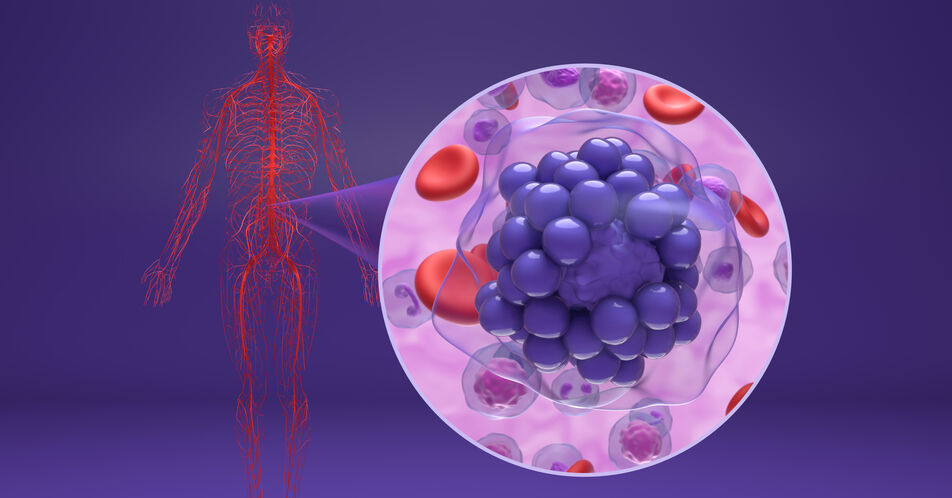 ASH: Polatuzumab Vedotin bei DLBCL auch nach 5 Jahren deutlich im Vorteil