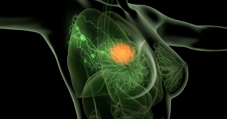 SABCS: Neue Daten unterstreichen den Nutzen adjuvanter CDK4/6-Inhibitoren bei frühem HR+/HER2- Brustkrebs