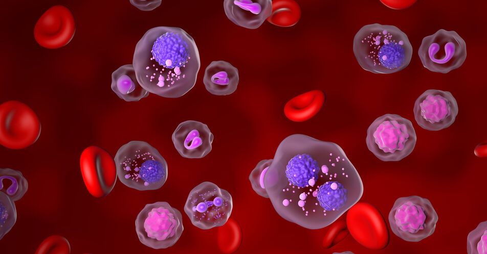 ASH: Daratumumab verzögert Progression des smoldering Multiplem Myelom in AQUILA-Studie